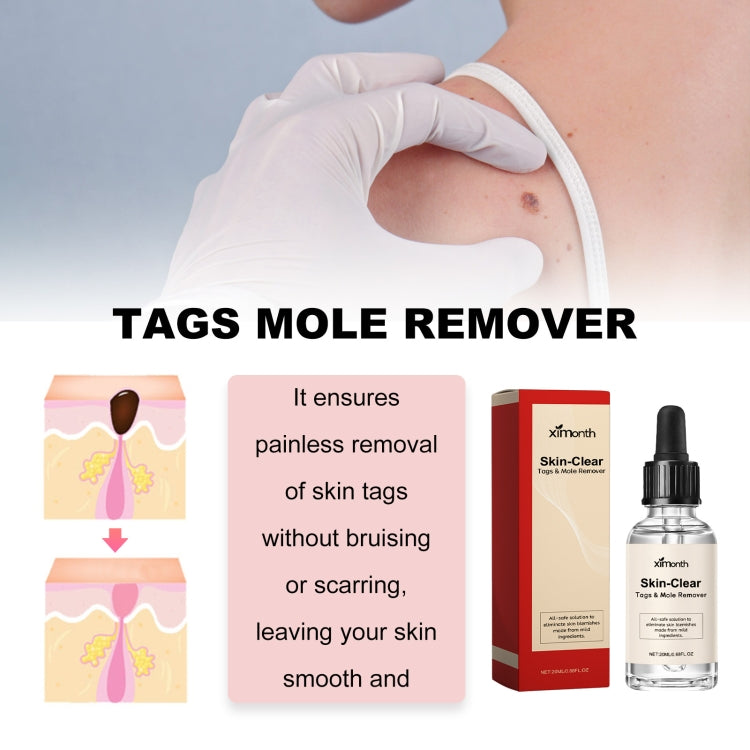 EELHOE 30 ml/bottiglia anti talpa e verruca liquido per rimuovere macchie scure essenza per la pelle
