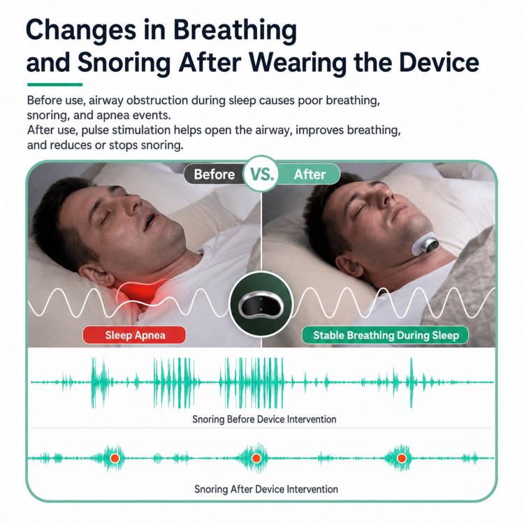 SNORE CIRCLE Dispositivo intelligente anti-russamento indossabile TENS ed EMA per bloccare il russare in gola con monitoraggio tramite app, aiuto per il sonno per adulti, YA4300