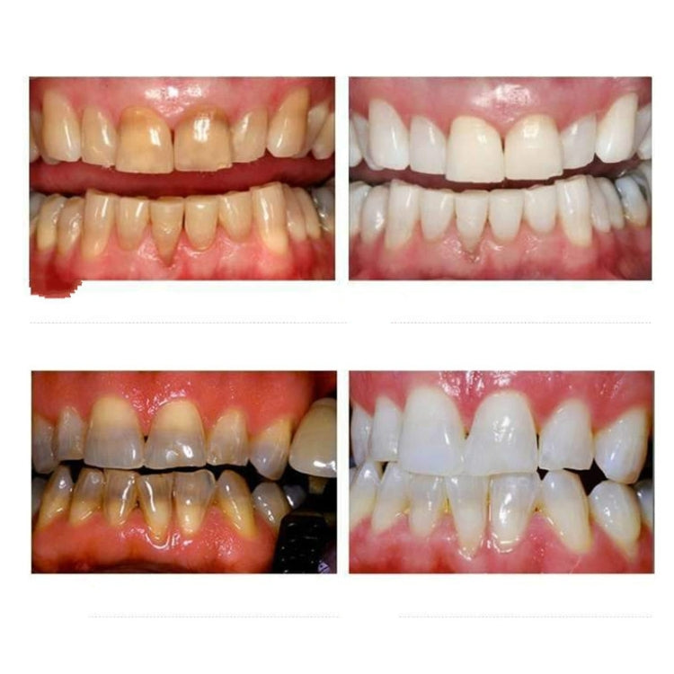 Set pulizia orale per sbiancamento denti Nano 10x10cm