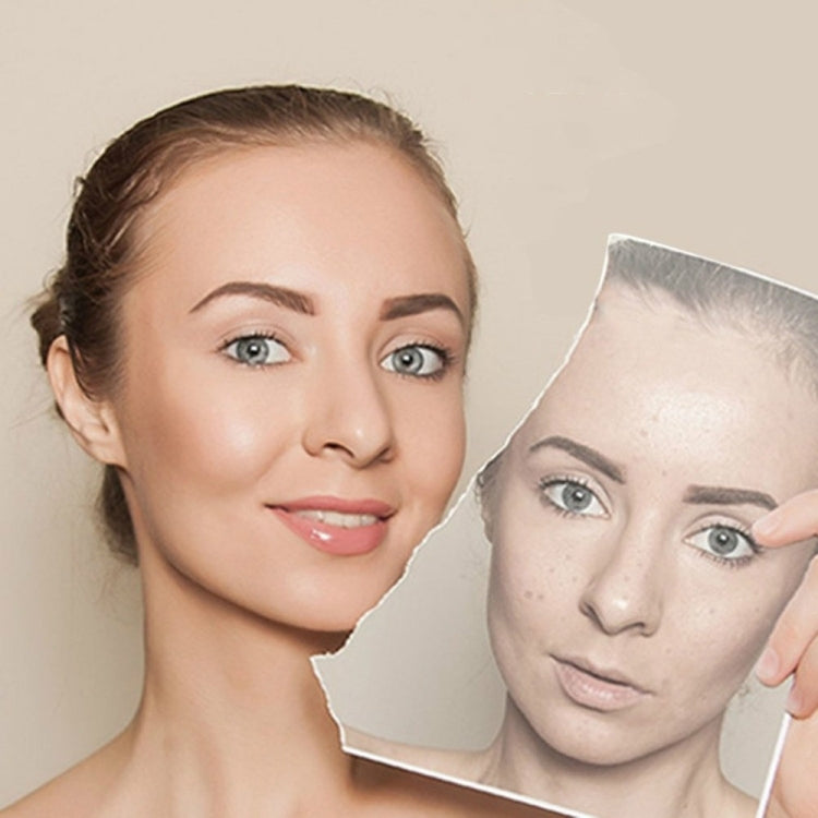 Macchina viso ad ultrasuoni 2 pezzi per cura pelle